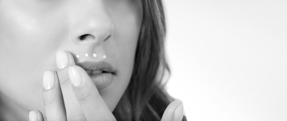 Melasma megjelenése az arcon