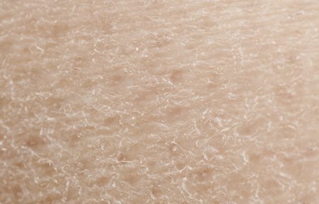 Közeli kép száraz bőrről