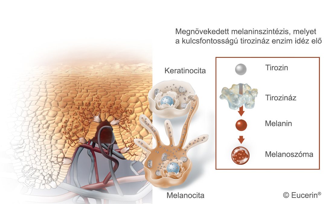 A bőrpigmentáció megjelenésének illusztrálása